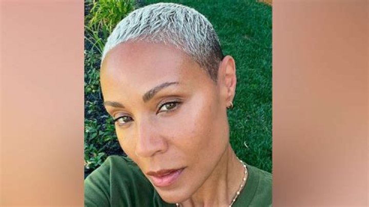 Jada Pinkett Smith's Alopecia Journey And Beyond